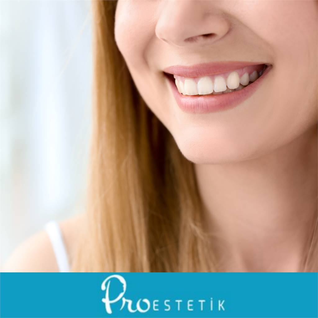  Hollywood Smile Sonrası Bakım Rehberi: 10 Altın Kural
