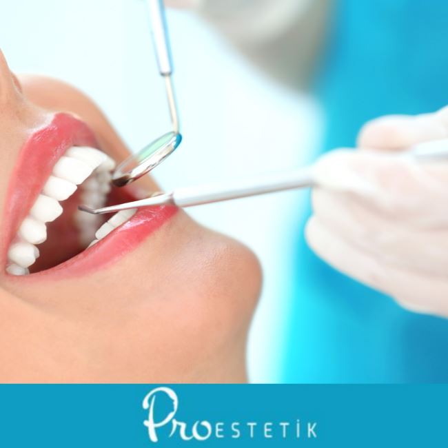 Restoratif Diş Tedavisi Nedir? Yöntemleri Nelerdir?