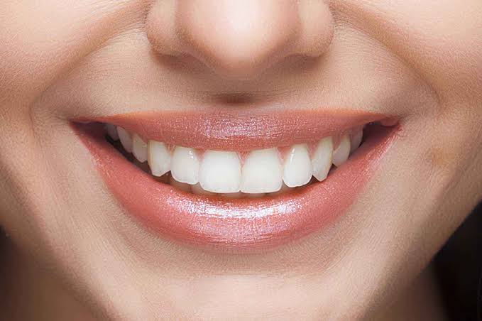 Gülüş Tasarımı Nedir?
