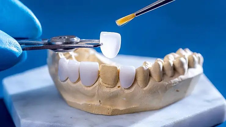 Metal Destekli Porselenden Zirkonyuma Geçiş: Değişime Değer mi?