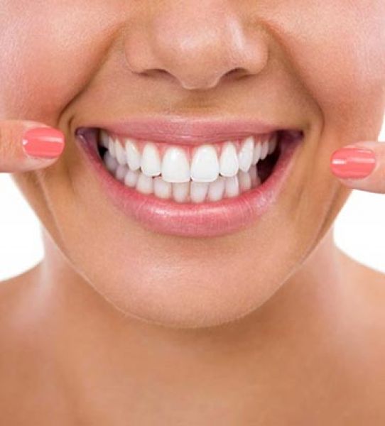 Ön Diş Kesişmelerinde Bonding: Üst Üste Binmiş Dişleri Bonding ile Düzeltmek