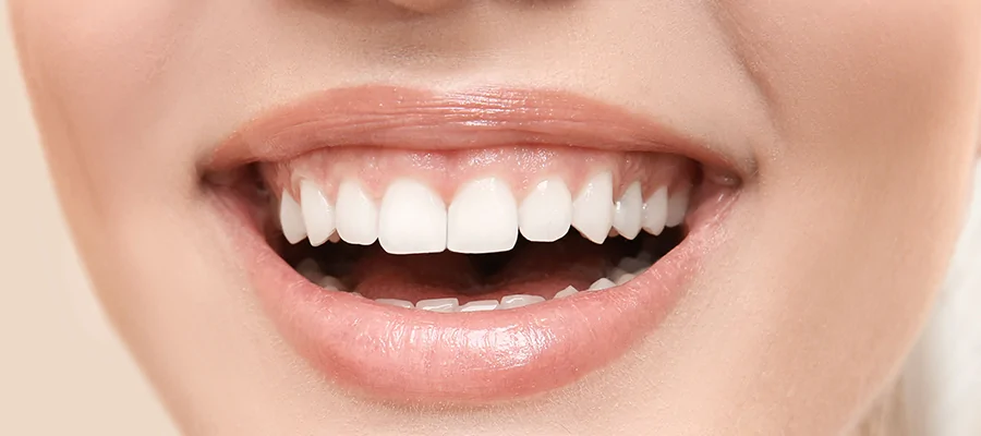 Gummy Smile Sorununda Lamine Yeterli mi? Diş Eti Estetiği ile Kombine Yaklaşımlar