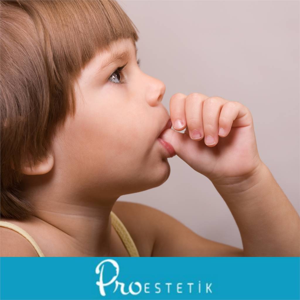 Bebeklerde Parmak Emme Alışkanlığının Dişlere Etkisi