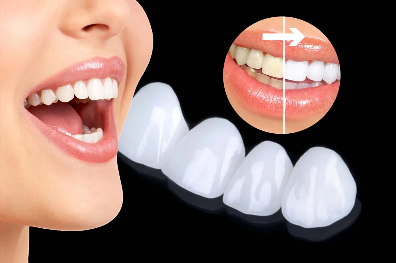 Zirkonyum Kaplamaların Değişim Zamanı: 10-15 Yıl Sonra Sizi Neler Bekliyor?